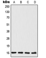 TSC22D1 / TSC22 Antibody - Western blot analysis of TSC22 expression in MCF7 (A); HeLa (B); mouse liver (C); rat liver (D) whole cell lysates.