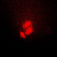 TSC22D1 / TSC22 Antibody - Immunofluorescent analysis of TSC22 staining in HeLa cells. Formalin-fixed cells were permeabilized with 0.1% Triton X-100 in TBS for 5-10 minutes and blocked with 3% BSA-PBS for 30 minutes at room temperature. Cells were probed with the primary antibody in 3% BSA-PBS and incubated overnight at 4 C in a humidified chamber. Cells were washed with PBST and incubated with a DyLight 594-conjugated secondary antibody (red) in PBS at room temperature in the dark. DAPI was used to stain the cell nuclei (blue).