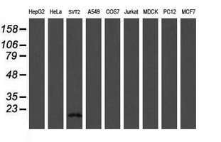 TSC22D1 / TSC22 Antibody - Western blot of extracts (35 ug) from 9 different cell lines by using g anti-TSC22D1 monoclonal antibody (HepG2: human; HeLa: human; SVT2: mouse; A549: human; COS7: monkey; Jurkat: human; MDCK: canine; PC12: rat; MCF7: human).