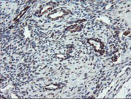 TSC22D1 / TSC22 Antibody - IHC of paraffin-embedded Human Ovary tissue using anti-TSC22D1 mouse monoclonal antibody.
