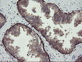 TSC22D1 / TSC22 Antibody - IHC of paraffin-embedded Human prostate tissue using anti-TSC22D1 mouse monoclonal antibody.