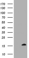 TSC22D1 / TSC22 Antibody - HEK293T cells were transfected with the pCMV6-ENTRY control (Left lane) or pCMV6-ENTRY TSC22D1 (Right lane) cDNA for 48 hrs and lysed. Equivalent amounts of cell lysates (5 ug per lane) were separated by SDS-PAGE and immunoblotted with anti-TSC22D1.