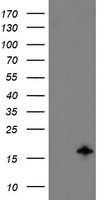 TSC22D1 / TSC22 Antibody - HEK293T cells were transfected with the pCMV6-ENTRY control (Left lane) or pCMV6-ENTRY TSC22D1 (Right lane) cDNA for 48 hrs and lysed. Equivalent amounts of cell lysates (5 ug per lane) were separated by SDS-PAGE and immunoblotted with anti-TSC22D1.
