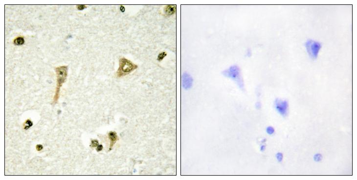 TSC22D1 / TSC22 Antibody - Peptide - + Immunohistochemistry analysis of paraffin-embedded human brain tissue using TSC22D1 antibody.