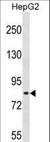 TSC22D2 Antibody - TSC22D2 Antibody western blot of HepG2 cell line lysates (35 ug/lane). The TSC22D2 antibody detected the TSC22D2 protein (arrow).