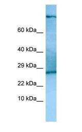 TSC22D2 Antibody - TSC22D2 antibody Western Blot of Rat Thymus.  This image was taken for the unconjugated form of this product. Other forms have not been tested.