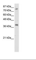 TSC22D2 Antibody - Transfected 293T Cell Lysate.  This image was taken for the unconjugated form of this product. Other forms have not been tested.