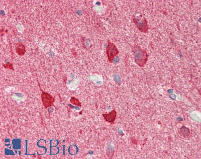 TSC22D2 Antibody - Human Brain, Cortex: Formalin-Fixed, Paraffin-Embedded (FFPE).  This image was taken for the unconjugated form of this product. Other forms have not been tested.