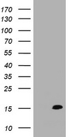 TSC22D3 / GILZ Antibody - HEK293T cells were transfected with the pCMV6-ENTRY control (Left lane) or pCMV6-ENTRY TSC22D3 (Right lane) cDNA for 48 hrs and lysed. Equivalent amounts of cell lysates (5 ug per lane) were separated by SDS-PAGE and immunoblotted with anti-TSC22D3.