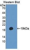 TSC22D3 / GILZ Antibody