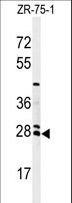 TSC501 / NAT8 Antibody - Western blot of NAT8 Antibody in ZR-75-1 cell line lysates (35 ug/lane). NAT8 (arrow) was detected using the purified antibody.
