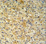 TSC501 / NAT8 Antibody - NAT8 Antibody IHC of formalin-fixed and paraffin-embedded mouse kidney tissue followed by peroxidase-conjugated secondary antibody and DAB staining.