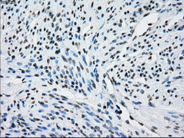 TSC501 / NAT8 Antibody - IHC of paraffin-embedded endometrium tissue using anti-NAT8 mouse monoclonal antibody. (Dilution 1:50).