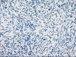 TSC501 / NAT8 Antibody - IHC of paraffin-embedded Ovary tissue using anti-NAT8 mouse monoclonal antibody. (Dilution 1:50).
