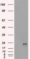 TSC501 / NAT8 Antibody - HEK293T cells were transfected with the pCMV6-ENTRY control (Left lane) or pCMV6-ENTRY NAT8 (Right lane) cDNA for 48 hrs and lysed. Equivalent amounts of cell lysates (5 ug per lane) were separated by SDS-PAGE and immunoblotted with anti-NAT8.