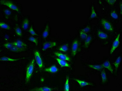 TSC501 / NAT8 Antibody - Immunofluorescent analysis of Hela cells using NAT8 Antibody at dilution of 1:100 and Alexa Fluor 488-congugated AffiniPure Goat Anti-Rabbit IgG(H+L)