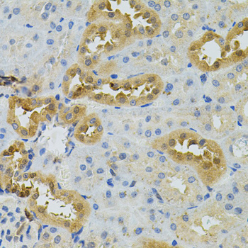 TSC501 / NAT8 Antibody - Immunohistochemistry of paraffin-embedded rat kidney tissue.