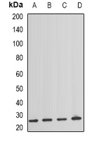 TSC501 / NAT8 Antibody - Western blot analysis of NAT8 expression in HEK293T (A); mouse spleen (B); mouse lung (C); rat kidney (D) whole cell lysates.