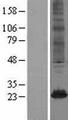 TSC501 / NAT8 Protein - Western validation with an anti-DDK antibody * L: Control HEK293 lysate R: Over-expression lysate
