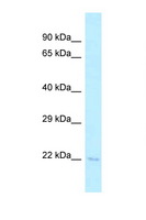 TSEN15 Antibody - TSEN15 antibody Western blot of Mouse Spleen lysate. Antibody concentration 1 ug/ml.  This image was taken for the unconjugated form of this product. Other forms have not been tested.