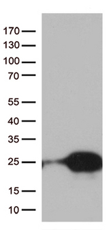 TSEN15 Antibody - HEK293T cells were transfected with the pCMV6-ENTRY control. (Left lane) or pCMV6-ENTRY TSEN15. (Right lane) cDNA for 48 hrs and lysed