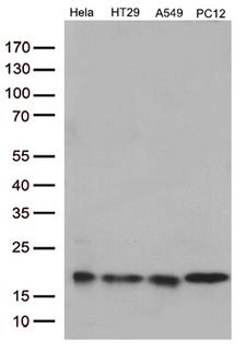 TSEN15 Antibody - Western blot analysis of extracts. (35ug) from 4 different cell lines by using anti-TSEN15 monoclonal antibody. (1:250)