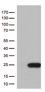 TSEN15 Antibody - HEK293T cells were transfected with the pCMV6-ENTRY control. (Left lane) or pCMV6-ENTRY TSEN15. (Right lane) cDNA for 48 hrs and lysed. Equivalent amounts of cell lysates. (5 ug per lane) were separated by SDS-PAGE and immunoblotted with anti-TSEN15. (1:500)