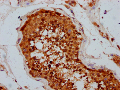 TSEN15 Antibody - Immunohistochemistry Dilution at 1:400 and staining in paraffin-embedded human testis tissue performed on a Leica BondTM system. After dewaxing and hydration, antigen retrieval was mediated by high pressure in a citrate buffer (pH 6.0). Section was blocked with 10% normal Goat serum 30min at RT. Then primary antibody (1% BSA) was incubated at 4°C overnight. The primary is detected by a biotinylated Secondary antibody and visualized using an HRP conjugated SP system.