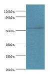 TSEN2 Antibody - Western blot. All lanes: TSEN2 antibody at 5 ug/ml+293T whole cell lysate. Secondary antibody: Goat polyclonal to rabbit at 1:10000 dilution. Predicted band size: 53 kDa. Observed band size: 53 kDa.