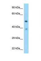 TSEN2 Antibody - TSEN2 antibody Western blot of Fetal Heart lysate. Antibody concentration 1 ug/ml.  This image was taken for the unconjugated form of this product. Other forms have not been tested.