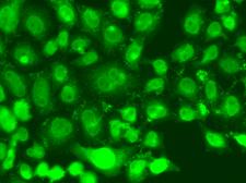 TSEN2 Antibody - Immunofluorescence analysis of A549 cells.