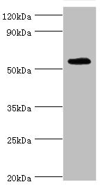 TSEN2 Antibody - Western blot All Lanes:TSEN2 antibody at 5ug/ml+293T whole cell lysate Secondary Goat polyclonal to rabbit at 1/10000 dilution Predicted band size: 54,52,50,48,46 kDa Observed band size: 53 kDa
