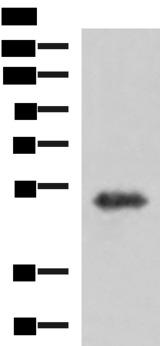TSEN2 Antibody - Western blot analysis of Human fetal brain tissue lysate  using TSEN2 Polyclonal Antibody at dilution of 1:1000