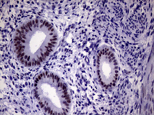 TSEN34 Antibody - Immunohistochemical staining of paraffin-embedded Human endometrium tissue within the normal limits using anti-TSEN34 mouse monoclonal antibody. (Heat-induced epitope retrieval by 1mM EDTA in 10mM Tris buffer. (pH8.5) at 120°C for 3 min. (1:150)