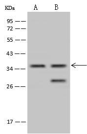 TSEN34 Antibody - Anti-TSEN34 rabbit polyclonal antibody at 1:500 dilution. Lane A: HCT-116 Whole Cell Lysate. Lane B: U-251 MG Whole Cell Lysate. Lysates/proteins at 30 ug per lane. Secondary: Goat Anti-Rabbit IgG (H+L)/HRP at 1/10000 dilution. Developed using the ECL technique. Performed under reducing conditions. Predicted band size: 34 kDa. Observed band size: 36 kDa. (We are unsure as to the identity of these extra bands.)