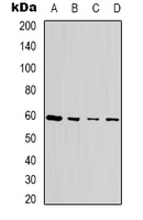 TSEN54 Antibody - Western blot analysis of SEN54 expression in MCF7 (A); Jurkat (B); HEK293T (C); NIH3T3 (D) whole cell lysates.