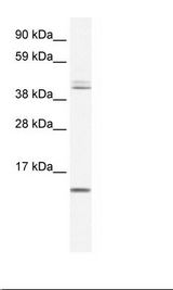 TSFM Antibody - Fetal Liver Lysate.  This image was taken for the unconjugated form of this product. Other forms have not been tested.