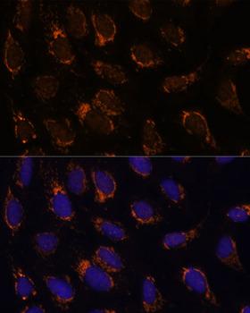 TSFM Antibody - Immunofluorescence analysis of U-2OS cells using TSFM Polyclonal Antibody at dilution of 1:100 (40x lens).Blue: DAPI for nuclear staining.
