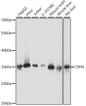 TSFM Antibody - Western blot analysis of extracts of various cell lines using TSFM Polyclonal Antibody at dilution of 1:1000.