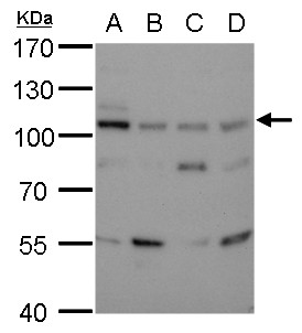 TSG101 Antibody - Detection of DNA Ligase III in 30ug of whole cell lysates of (A) 293T cells, (B) A431 cells, (C) HeLa cells, and (D) HepG2 cells