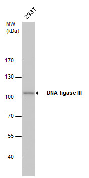 TSG101 Antibody - Western blot analysis of Akirin1 in rat liver lysate