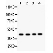 TSG101 Antibody - TSG101 antibody Western blot. All lanes: Anti TSG101 at 0.5 ug/ml. Lane 1: Rat Cardiac Muscle Tissue Lysate at 50 ug. Lane 2: Rat Brain Tissue Lysate at 50 ug. Lane 3: HELA Whole Cell Lysate at 40 ug. Lane 4: SMMC Whole Cell Lysate at 40 ug. Predicted band size: 44 kD. Observed band size: 44 kD.