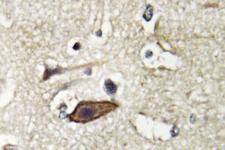 TSG101 Antibody - IHC of Tsg 101 (E303) pAb in paraffin-embedded human brain tissue.