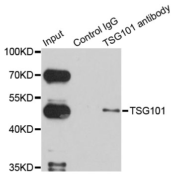 TSG101 Antibody - Immunoprecipitation analysis of 150ug extracts of HeLa cells.