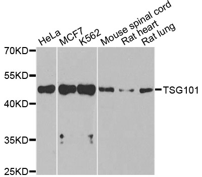 TSG101 Antibody - Western blot analysis of extracts of various cell lines, using TSG101 antibody at 1:1000 dilution. The secondary antibody used was an HRP Goat Anti-Rabbit IgG (H+L) at 1:10000 dilution. Lysates were loaded 25ug per lane and 3% nonfat dry milk in TBST was used for blocking. An ECL Kit was used for detection and the exposure time was 40s.