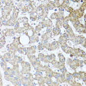 TSG101 Antibody - Immunohistochemistry of paraffin-embedded human liver injury using TSG101 antibodyat dilution of 1:100 (40x lens).