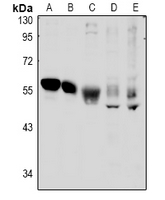 TSG101 Antibody - Western blot analysis of TSG101 expression in Hela (A), mouse brain (B), rat brain (C), PC3 (D), HEK293T (E) whole cell lysates.
