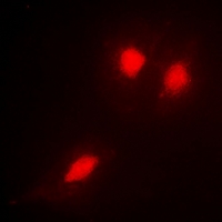 TSG101 Antibody - Immunofluorescent analysis of TSG101 staining in HeLa cells. Formalin-fixed cells were permeabilized with 0.1% Triton X-100 in TBS for 5-10 minutes and blocked with 3% BSA-PBS for 30 minutes at room temperature. Cells were probed with the primary antibody in 3% BSA-PBS and incubated overnight at 4 °C in a hidified chamber. Cells were washed with PBST and incubated with Alexa Fluor 647-conjugated secondary antibody (red) in PBS at room temperature in the dark.