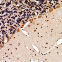 TSG101 Antibody - Immunohistochemical analysis of TSG101 staining in human brain formalin fixed paraffin embedded tissue section. The section was pre-treated using heat mediated antigen retrieval with sodium citrate buffer (pH 6.0). The section was then incubated with the antibody at room temperature and detected using an HRP conjugated compact polymer system. DAB was used as the chromogen. The section was then counterstained with haematoxylin and mounted with DPX.