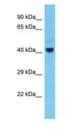 TSG101 Antibody - TSG101 antibody Western Blot of Thymus tumor. Antibody dilution: 1 ug/ml.  This image was taken for the unconjugated form of this product. Other forms have not been tested.